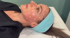 Korean Beauty Spicule Treatment