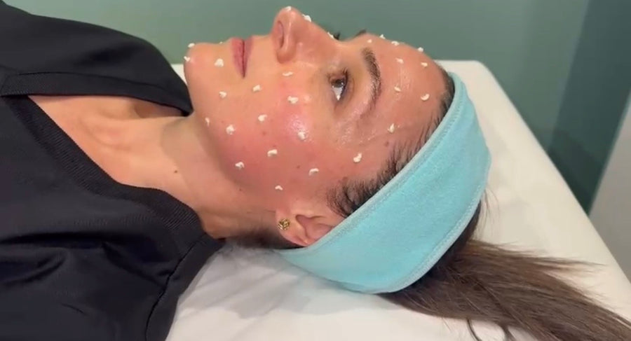 Dr Spi-cure – Korean Spicule Treatment